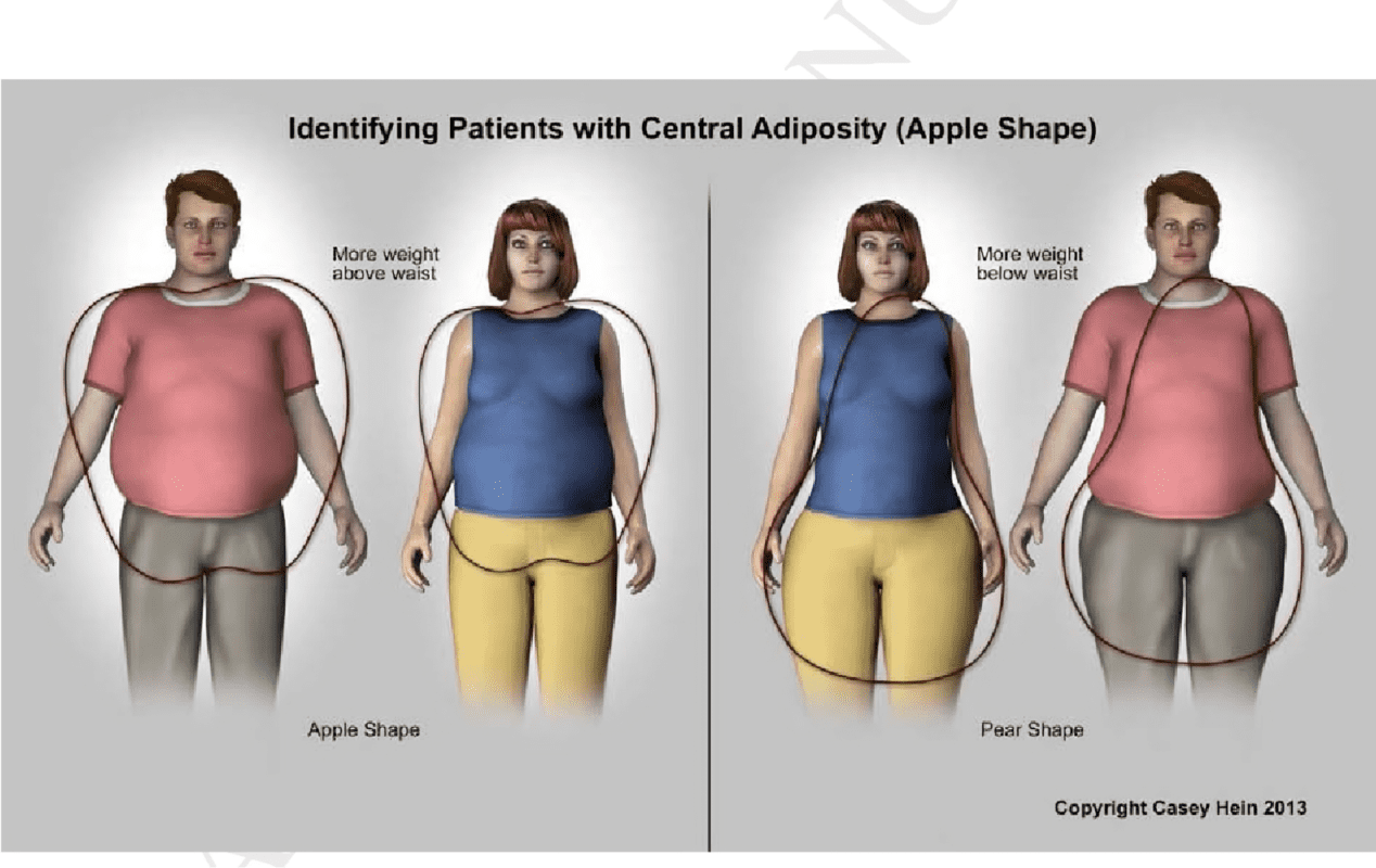 obesitas sentral