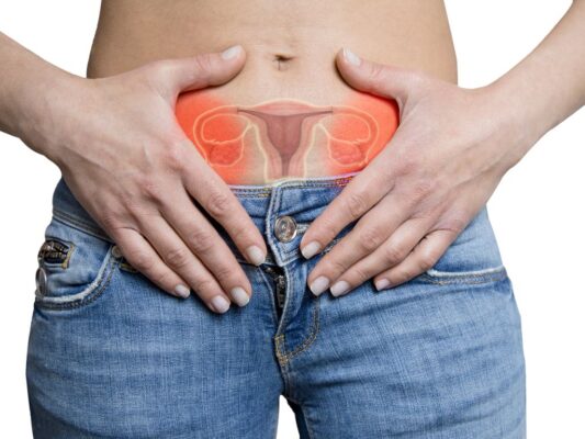 pcos-kanker